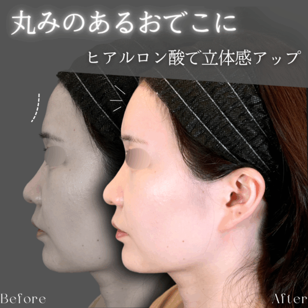 No.9101の症例写真